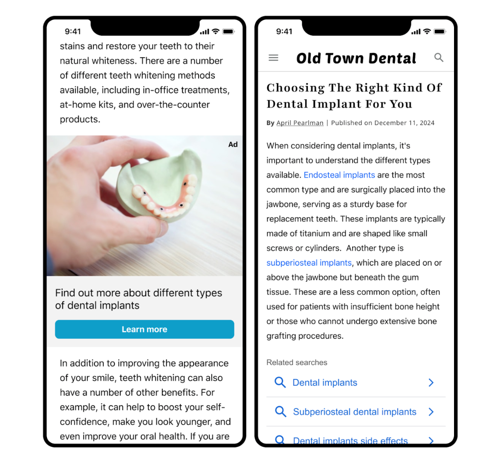related search on content example with dental article and search-based ad units